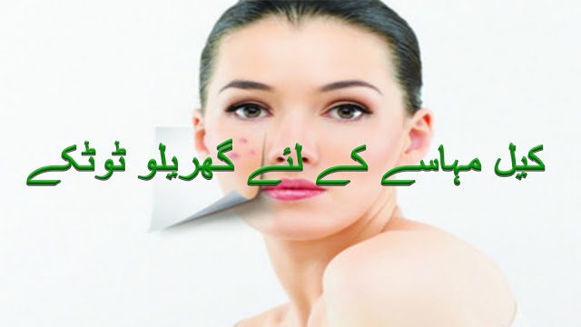 Acne Tips in urdu and hindi | Keel mahase kay liye gharelu totkay