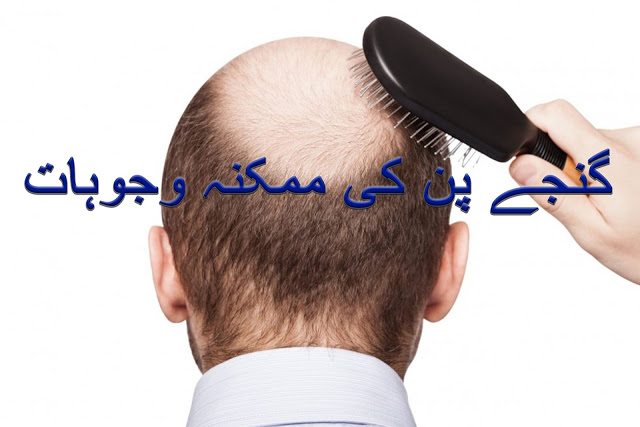 Causes of baldness for men and women in urdu and hindi