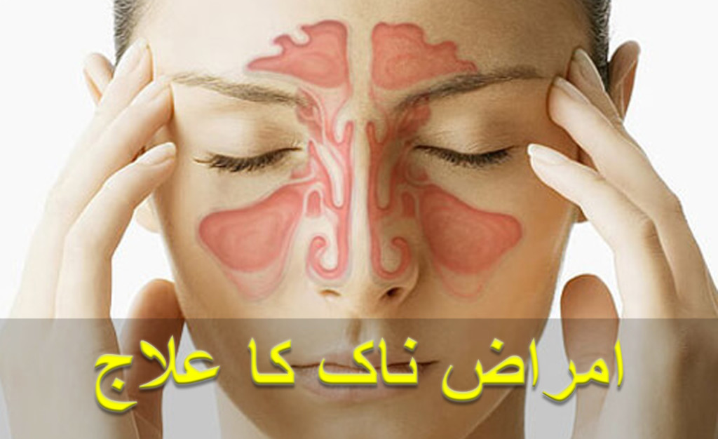 Home remedies for sinus and allergies in urdu